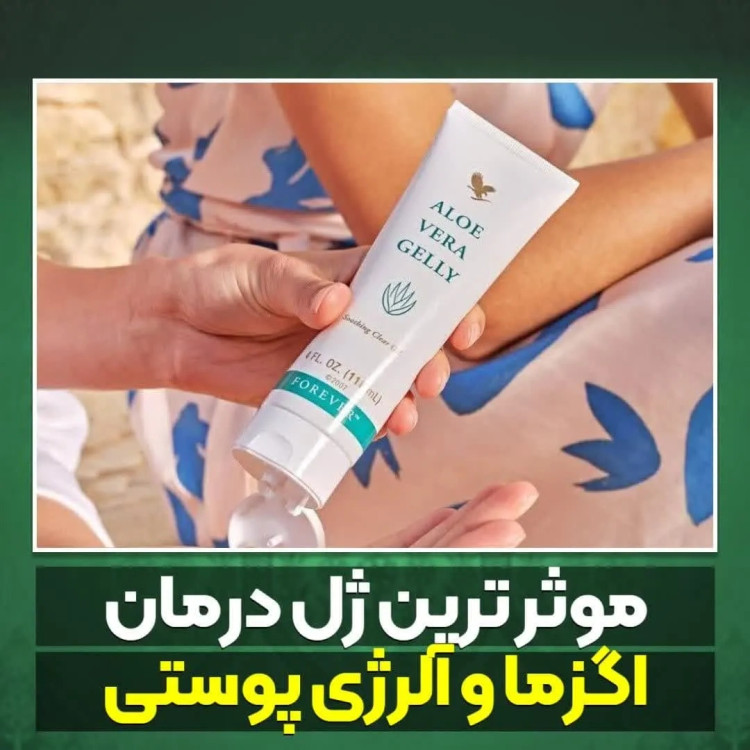 ژل درمانی آلوئه ورا